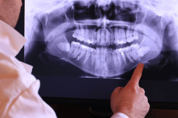 Best Pediatric Emergency Dentist in China Spring, TX