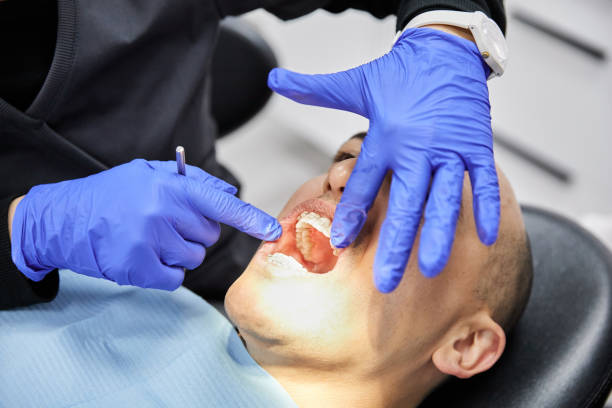 Best Urgent Dental Care for Toothache in China Spring, TX